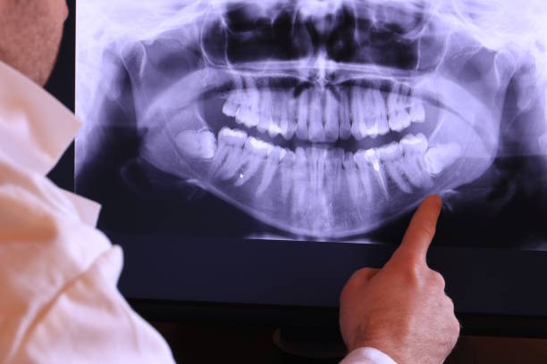 Best Emergency Dental Care for Abscessed Tooth in Tangelo Park, FL